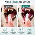 Pet Teeth Cleaning Wipes